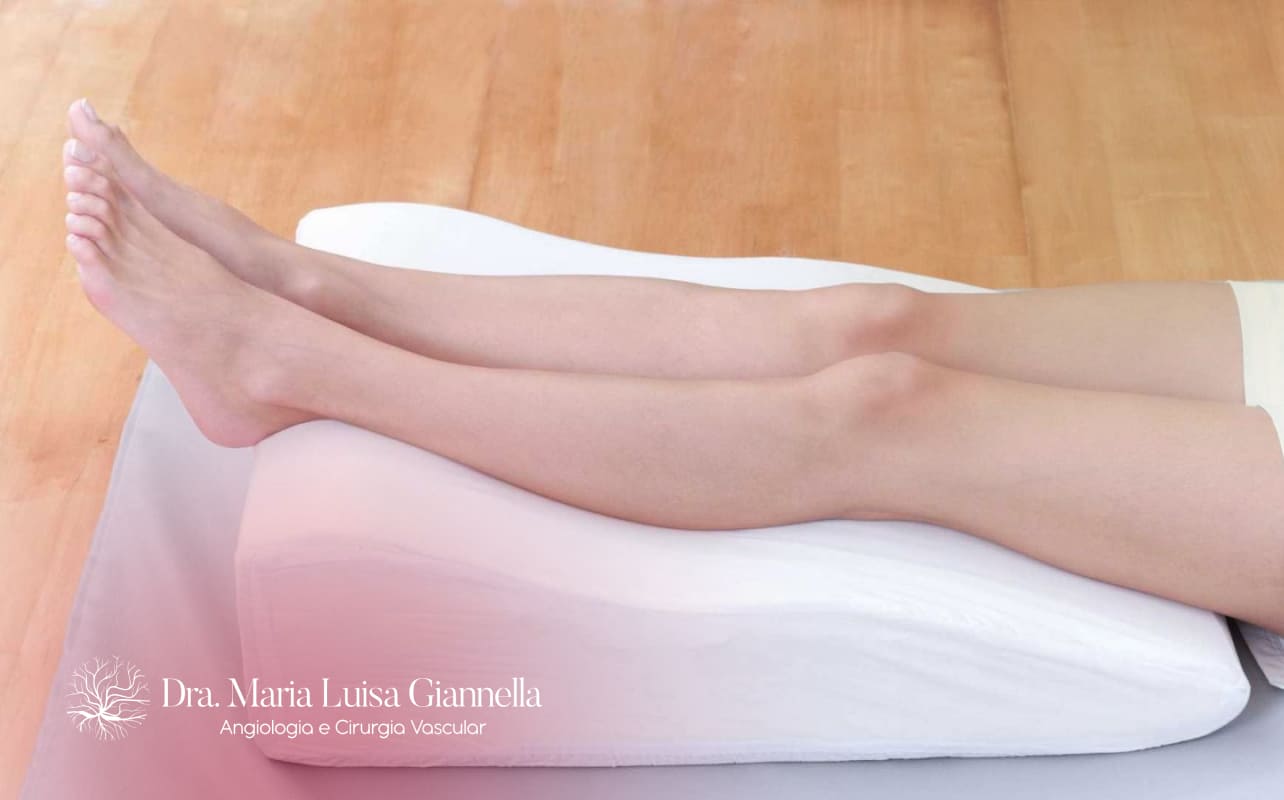 Post-Varicose Vein Surgery Care: Complete Guide for a Smooth and Safe Recovery