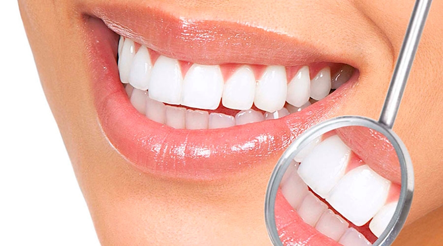 Lente de contato dental para um sorriso de estrela - Clínica Odontológica  em Copacabana | Dentista em Copacabana