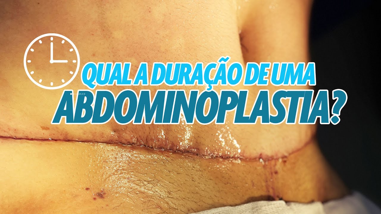 Abdominoplastia: Tudo que você precisa saber antes de operar! - YouTube